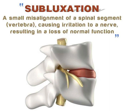 Spinal health education diagram explaining what is a subluxation and nervous system chiropractic care at Life is Good Chiropractic.